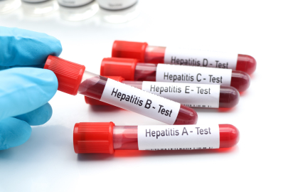 “Birinci derece yakınlarında hepatit olanlar mutlaka taramadan geçmeli"